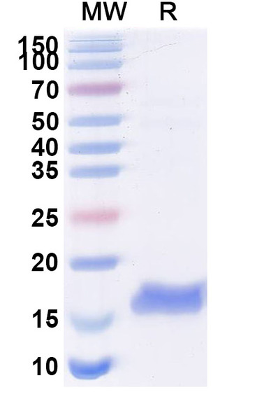 Anti-Human CTNNB1 Recombinant Nanobody (SAA1188) - SDS-PAGE