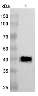 Anti-Human ATP7B Recombinant Nanobody (SAA1241) - WB