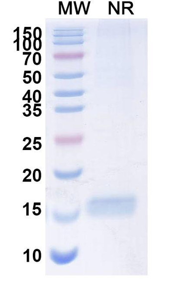 Anti-Human CD309/KDR/VEGFR-2 Recombinant Nanobody (SAA1230) - SDS-PAGE
