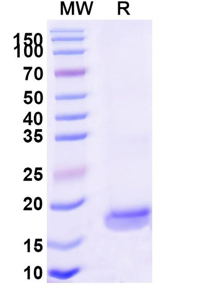 Anti-Human OPRK1 Recombinant Nanobody (SAA1169) - SDS-PAGE