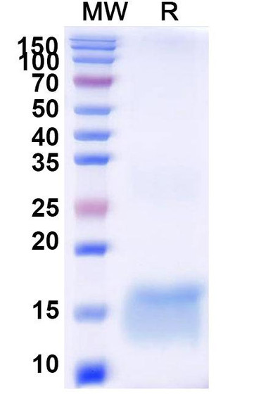 Anti-Human HTT Recombinant Nanobody (SAA1178) - SDS-PAGE