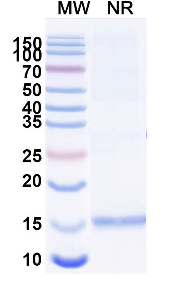 Anti-Human HTT Recombinant Nanobody (SAA1032) - SDS-PAGE