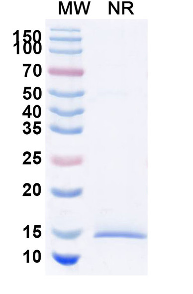Anti-Human HTT Recombinant Nanobody (SAA1033) - SDS-PAGE