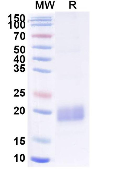 Anti-Human ACTB/β-actin/Beta Actin Recombinant Nanobody (SAA1234) - SDS-PAGE