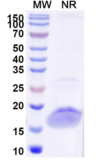 Anti-Human LYZ Recombinant Nanobody (SAA1052) - SDS-PAGE