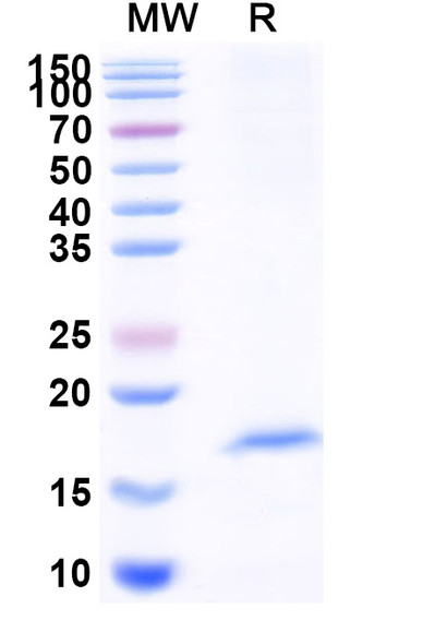 Anti-Human OLR1/LOX1 Recombinant Nanobody (SAA1291) - SDS-PAGE