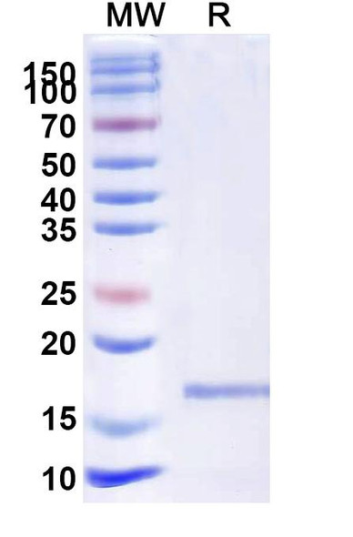 Anti-Human CD339/JAG1 Recombinant Nanobody (SAA1285) - SDS-PAGE
