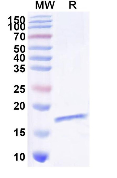 Anti-Human CD136/MST1R/RON Recombinant Nanobody (SAA1369) - SDS-PAGE