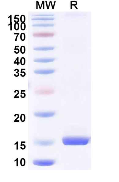Anti-Human BAX Recombinant Nanobody (SAA1222) - SDS-PAGE