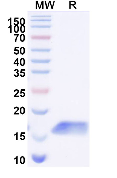 Anti-Human CDH17/Cadherin-17 Recombinant Nanobody (SAA1325) - SDS-PAGE