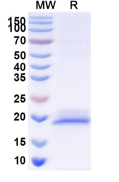 Anti-Human TRIM28 Recombinant Nanobody (SAA1235) - SDS-PAGE