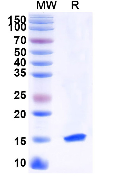 Anti-Human PTCH1 Recombinant Nanobody (SAA1040) - SDS-PAGE
