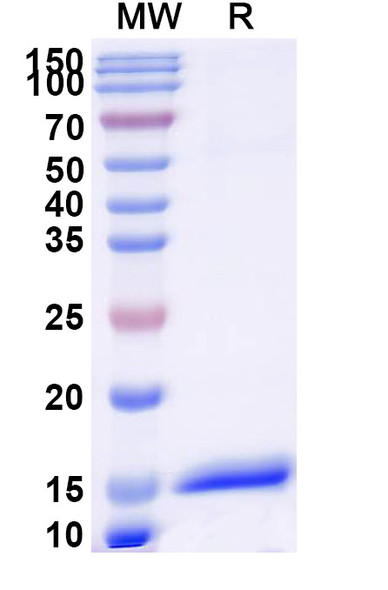 Anti-Human ANGPT1 Recombinant Nanobody (SAA1256) - SDS-PAGE