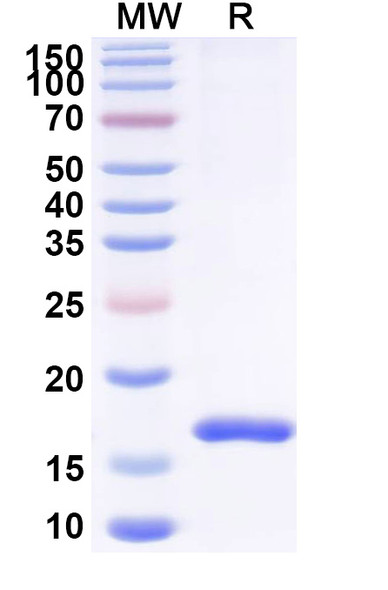 Anti-Human GPR68 Recombinant Nanobody (SAA1363) - SDS-PAGE