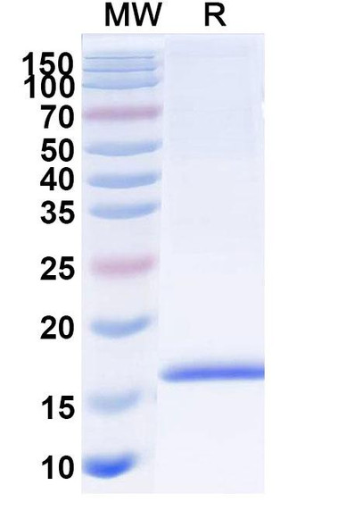 Anti-Human Adiponectin/ACRP30/ADIPOQ Recombinant Nanobody (SAA1153) - SDS-PAGE