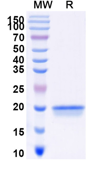 Anti-Human CD167b/DDR2 Recombinant Nanobody (SAA0978) - SDS-PAGE