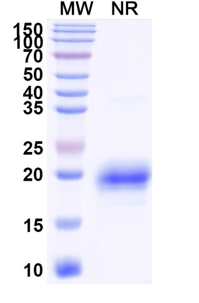 Anti-Human CD366/HAVCR2/TIM-3 Recombinant Nanobody (SAA1348) - SDS-PAGE