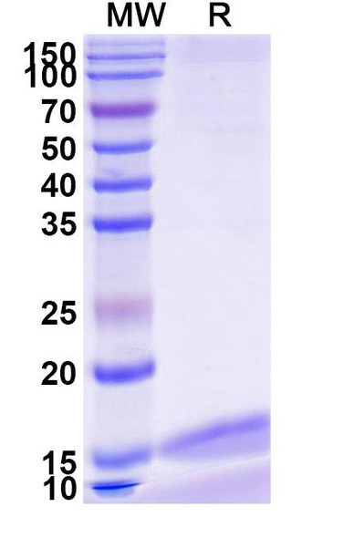 Anti-Human CD217/IL17RA Recombinant Nanobody (SAA1266) - SDS-PAGE