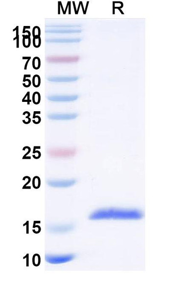 Anti-Human CPB2 Recombinant Nanobody (SAA1167) - SDS-PAGE