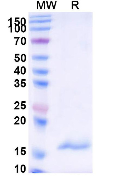 Anti-Human CPB2 Recombinant Nanobody (SAA1018) - SDS-PAGE
