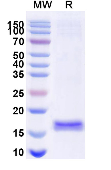 Anti-Human CD114/CSF3R Recombinant Nanobody (SAA1247) - SDS-PAGE