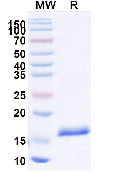 Anti-Human IL23A/IL-23p19 Recombinant Nanobody (SAA1160) - SDS-PAGE