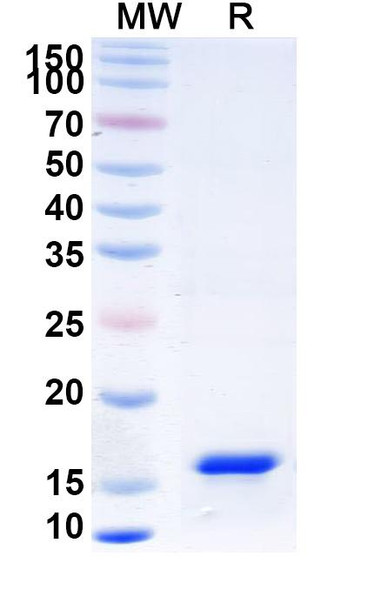 Anti-Human IL17RB Recombinant Nanobody (SAA1267) - SDS-PAGE