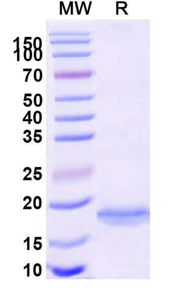 Anti-Human RAGE-1/MOK Recombinant Nanobody (SAA1290) - SDS-PAGE