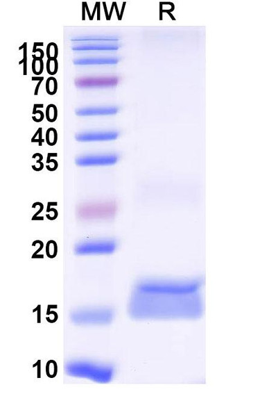 Anti-Human AKT3 Recombinant Nanobody (SAA1232) - SDS-PAGE