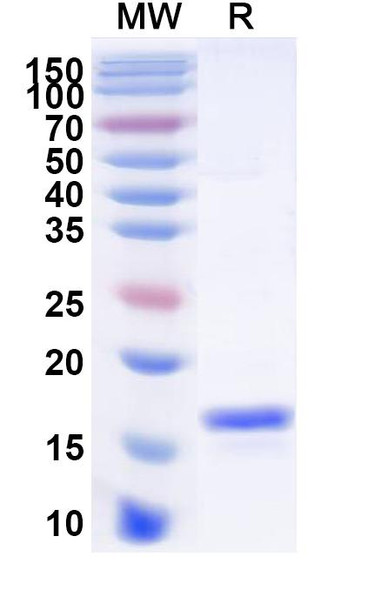 Anti-Human ANGPT4 Recombinant Nanobody (SAA1257) - SDS-PAGE