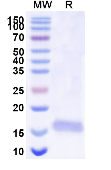 Anti-Human BACE2 Recombinant Nanobody (SAA0876) - SDS-PAGE