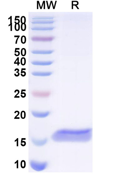 Anti-Human BACE2 Recombinant Nanobody (SAA1031) - SDS-PAGE
