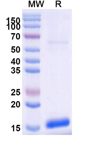 Anti-Human SLC5A8 Recombinant Nanobody (SAA0962) - SDS-PAGE