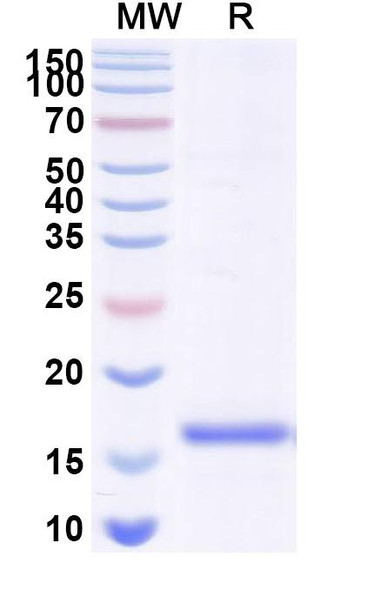 Anti-Human GPHN/Gephyrin Recombinant Nanobody (SAA1333) - SDS-PAGE