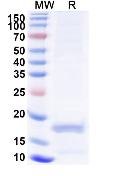 Anti-Human MLPH Recombinant Nanobody (SAA1233) - SDS-PAGE