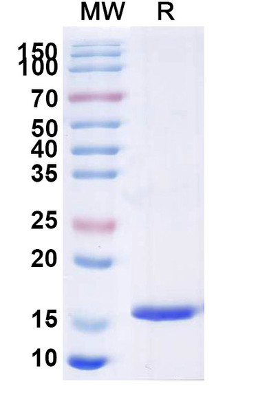 Anti-Mouse H2-Ab1/MHCII Recombinant Nanobody (SAA1323) - SDS-PAGE