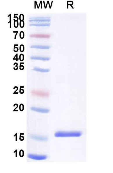 Anti-SARS-CoV-2 S Protein Recombinant Nanobody (SAA0893) - SDS-PAGE