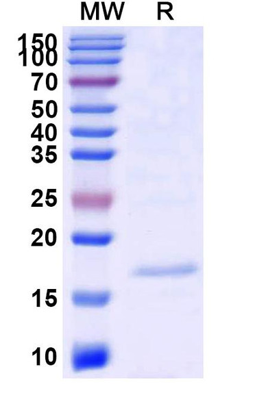 Anti-SARS-CoV-2 S Protein Recombinant Nanobody (SAA0909) - SDS-PAGE