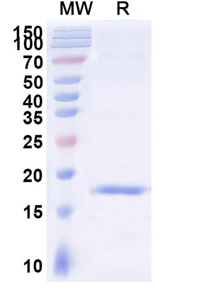 Anti-SARS-CoV-2 S Protein Recombinant Nanobody (SAA0911) - SDS-PAGE