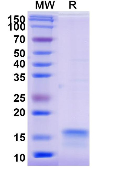 Anti-SARS-CoV-2 S Protein Recombinant Nanobody (SAA0913) - SDS-PAGE