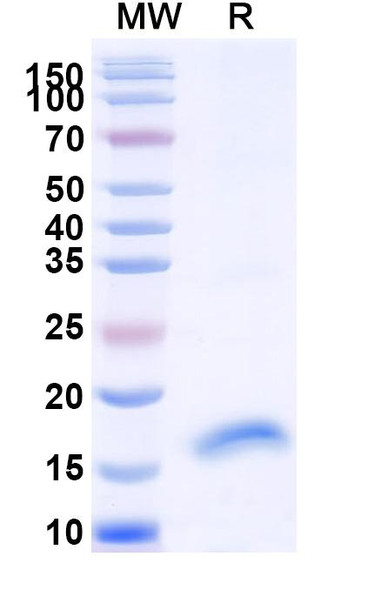 Anti-SARS-CoV-2 S Protein Recombinant Nanobody (SAA0914) - SDS-PAGE