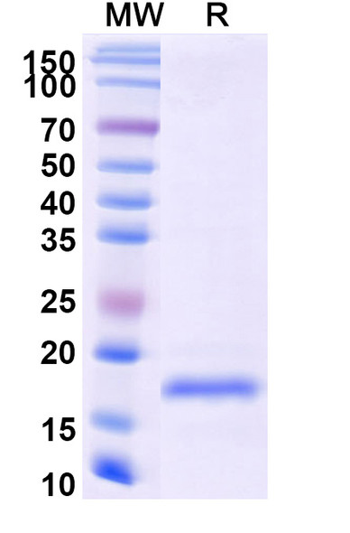 Anti-SARS-CoV-2 S Protein Recombinant Nanobody (SAA0916) - SDS-PAGE