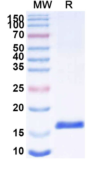Anti-SARS-CoV-2 S Protein Recombinant Nanobody (SAA0942) - SDS-PAGE