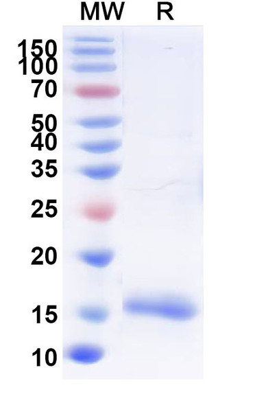 Anti-SARS-CoV-2 S Protein Recombinant Nanobody (SAA0946) - SDS-PAGE