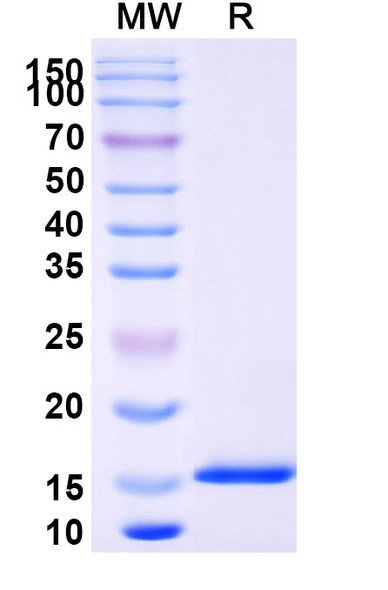 Anti-SARS-CoV-2 S Protein Recombinant Nanobody (SAA0951) - SDS-PAGE