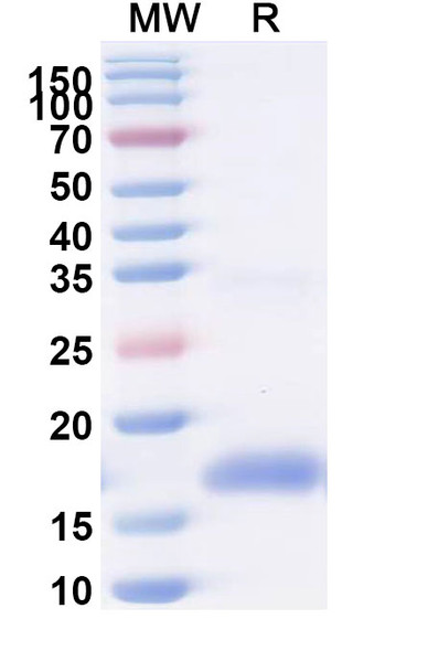 Anti-SARS-CoV-2 S Protein Recombinant Nanobody (SAA0996) - SDS-PAGE