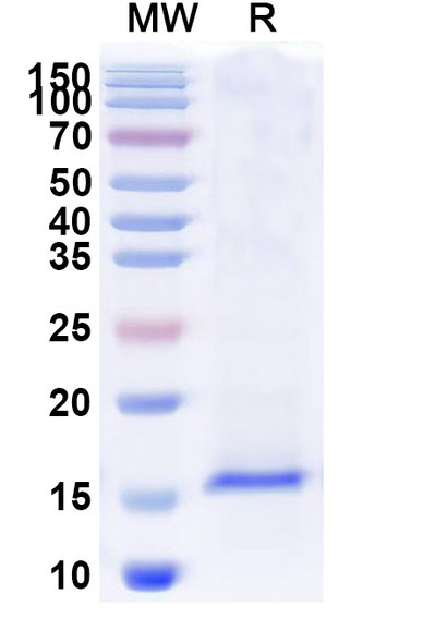 Anti-SARS-CoV-2 S Protein Recombinant Nanobody (SAA1043) - SDS-PAGE