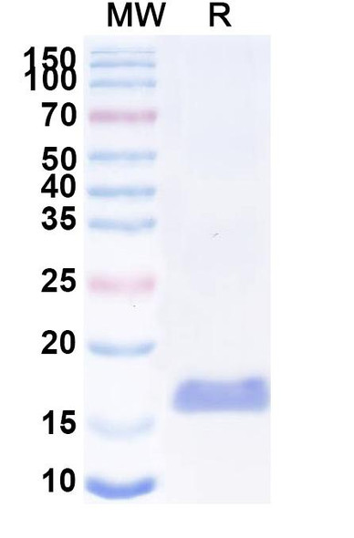 Anti-SARS-CoV-2 S Protein Recombinant Nanobody (SAA1057) - SDS-PAGE