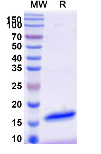 Anti-SARS-CoV-2 S Protein Recombinant Nanobody (SAA1059) - SDS-PAGE