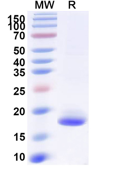 Anti-SARS-CoV-2 S Protein Recombinant Nanobody (SAA1062) - SDS-PAGE